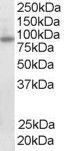 Anti-FOXO3A / FOXO3 / FKHRL1, C-terminal