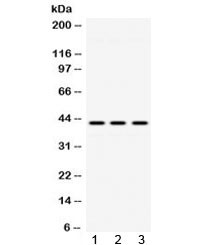 Anti-ACAA2
