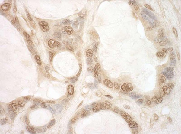 Anti-eIF2B5 (IHC)