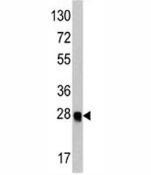 Anti-ATG12, clone 43CT73.3.5.5.4