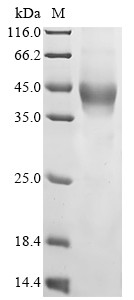 Transmembrane protein 119 (TMEM119), partial, human, recombinant