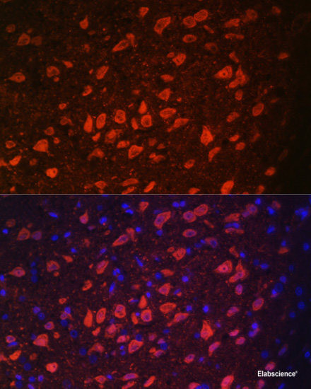 Anti-TRPM2