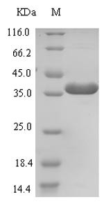 E3 ubiquitin-protein ligase ZNRF3 (ZNRF3), partial, human, recombinant