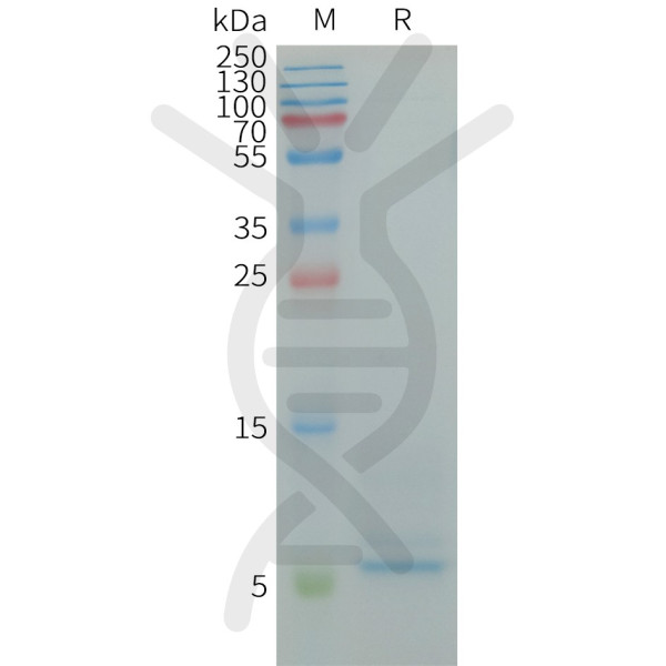 Human CD9 Protein, His Tag