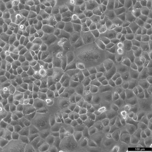SW-13 Cells