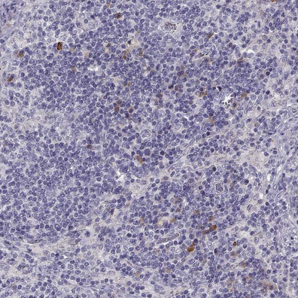 Anti-HTR3A