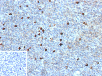 Anti-IGHG4 / Immunoglobulin heavy constant gamma 4, clone IGHG4/13367R