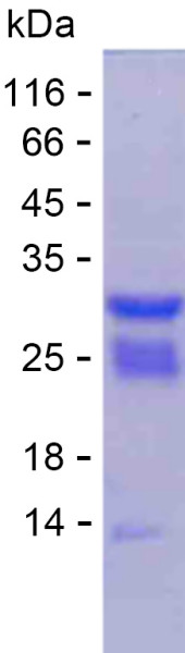 Recombinant Human AMER3 Protein