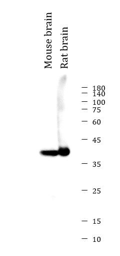 Anti-Synaptophysin, clone SQab19147
