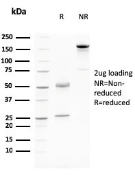 Anti-Desmoglein-3 (Squamous Cell Marker)(DSG3/2796), CF640R conjugate, 0.1mg/mL