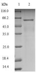 Leucine-rich repeat and immunoglobulin-like domain-containing nogo receptor-interacting protein 1 (L