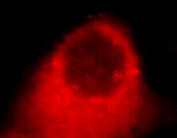 Anti-Keratin 7, clone 4G9-D8-H6, C-terminal