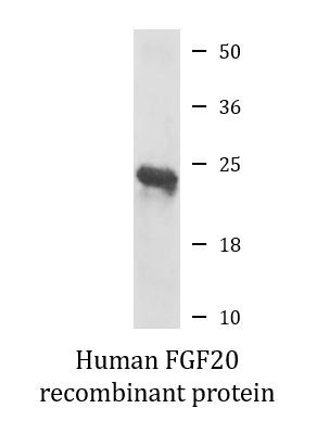 Human FGF20 recombinant protein (Active)