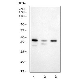 Anti-HSD17B1