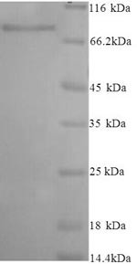 Inactive N-acetylated-alpha-linked acidic dipeptidase-like protein 2 (NAALADL2), partial, human, rec