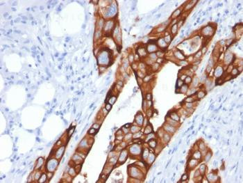 Anti-Cytokeratin 20 (KRT20) (Colorectal Epithelial Marker) Monoclonal Antibody (Clone: KRT20/1991)