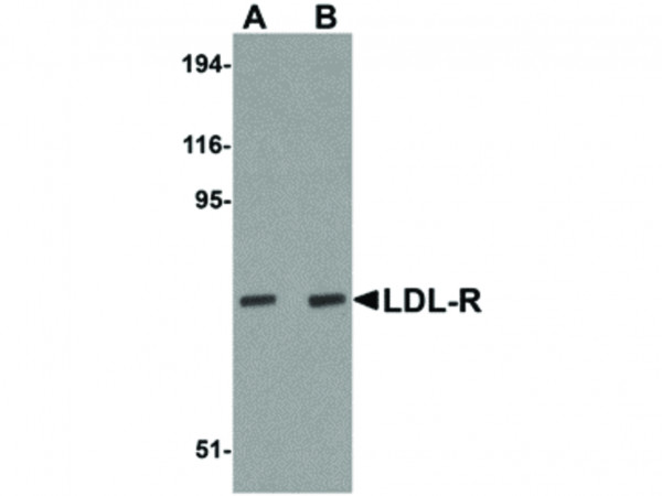 Anti-LDL-R