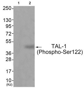 Anti-Phospho-TAL1 (Ser122)