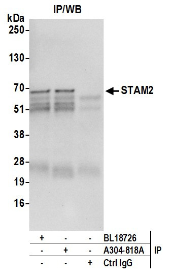 Anti-STAM2