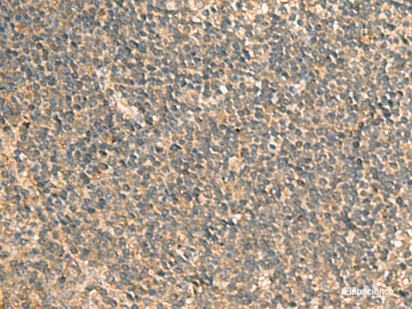 Anti-GPBP1