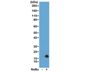 Anti-H3K4ac / Acetyl Histone H3 Lysine 4, clone RM149 (recombinant antibody)