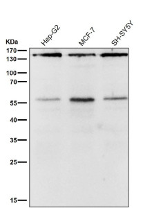 Anti-ROCK1 / Rho associated coiled coil containing protein kinase 1, clone 32R84