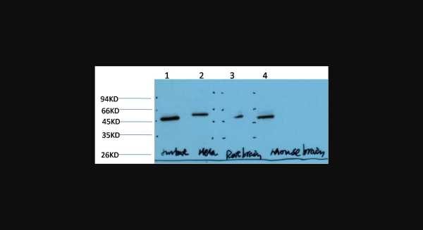 Anti-Gamma Tubulin (6C12), monoclonal