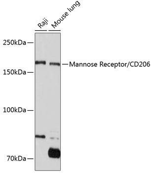 Anti-Mannose Receptor/CD206