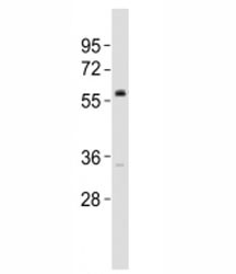 Anti-VANGL2