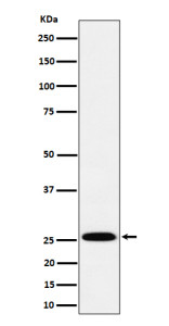 Anti-INMT / Indolethylamine N-methyltransferase, clone 29I76