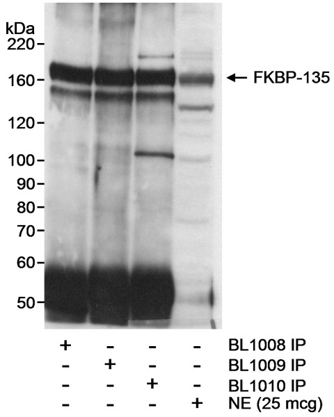 Anti-FKBP-135