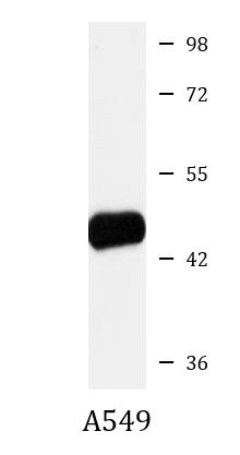 Anti-SLC7A5 / LAT1