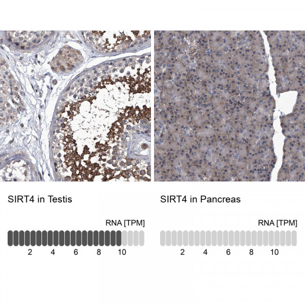 Anti-SIRT4