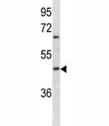 Anti-ABO, clone 593CT3.2.2