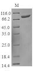 Killer cell immunoglobulin-like receptor 2DS3 (KIR2DS3), partial, human, recombinant