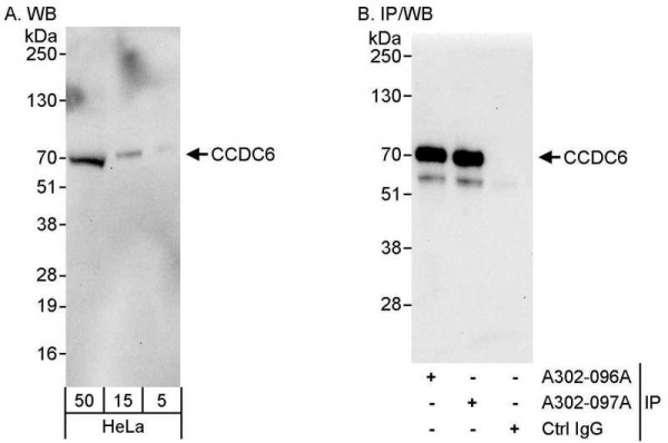 Anti-CCDC6