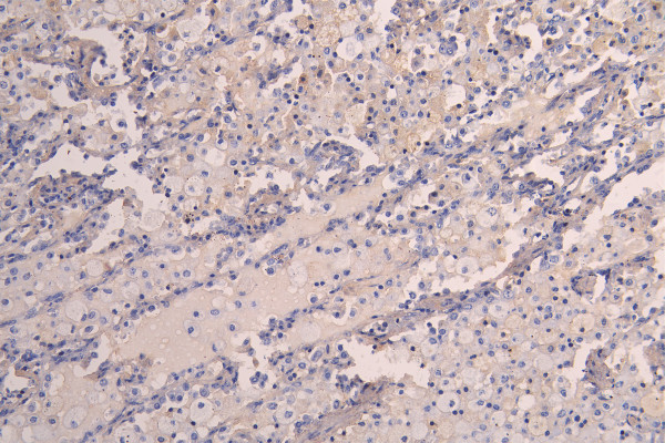 Anti-KDR, recombinant clone 11F8