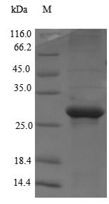 Mediator of RNA polymerase II transcription subunit 1 (MED1), partial, human, recombinant