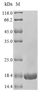 60S acidic ribosomal protein P2 (RPLP2), human, recombinant