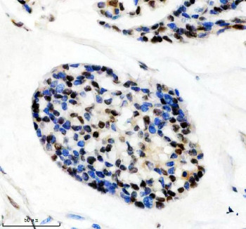 Anti-HTATSF1 / HIV Tat-specific factor 1, clone 25H56