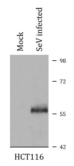Anti-phospho-IRF3 (Ser396)