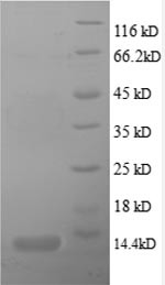 C-X-C motif chemokine 5 (CXCL5), partial, human, recombinant