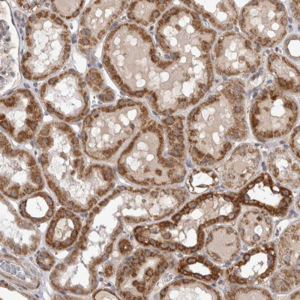 Anti-KCNIP1