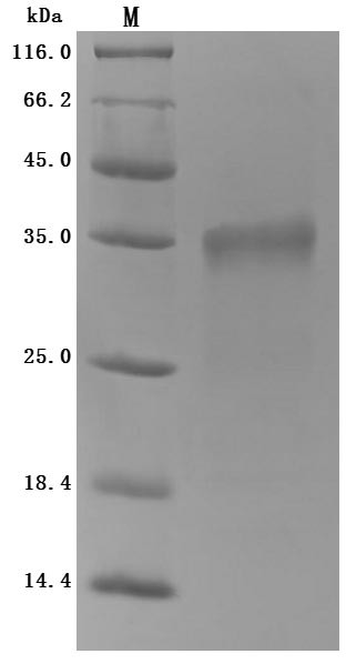 Prolactin receptor (Prlr), partial (Active), mouse, recombinant