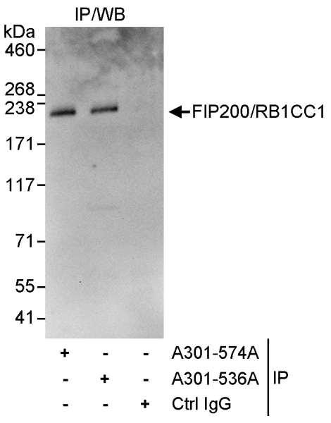 Anti-FIP200/RB1CC1