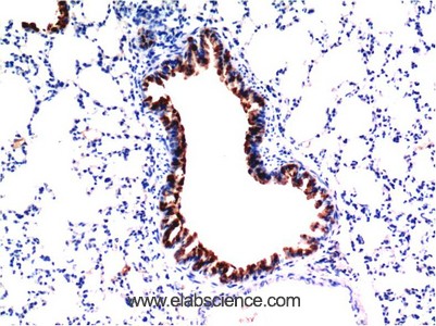 Anti-TGFB1, clone 5D2