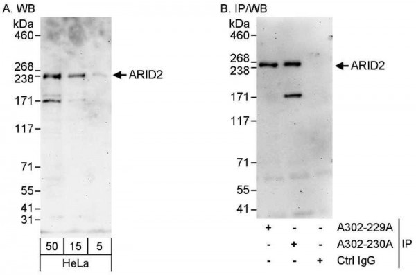 Anti-ARID2