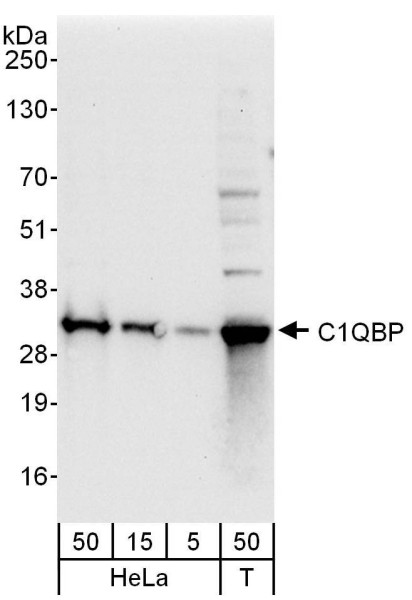Anti-C1QBP