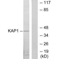 Anti-PRKAR1B