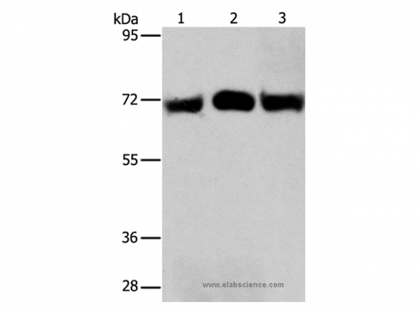 Anti-RPN1